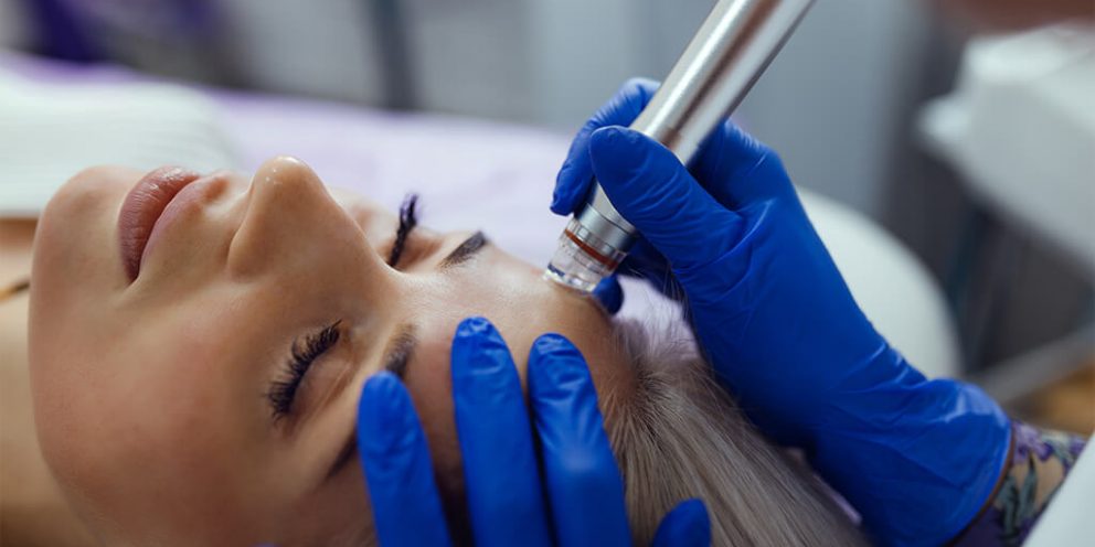 Microdermoabrasion-beneficios-que-trae-para-su-rostro